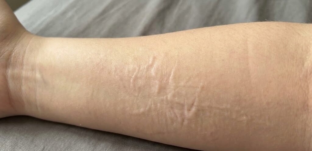 long term effect on body